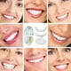 thumbnail image 4 of Upper & Lower Teeth Veneers - 2 Pairs Simulation Braces Sp On Veneers Smile Fake Teeth Cover Imperfect Teeth Perfect Whitening False Teeth One Size De, 4 of 5