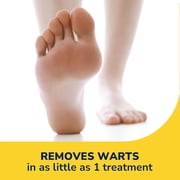 Dr. Scholl's Freeze Away Wart Remover for Hands & Feet, 12 Treatments
