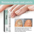 thumbnail image 2 of Fungal Nail Treatment Pen for Toenails and Fingernails, Anti Fungus Nail Strengthener for Ingrown & Thick Nail Infection Treatment New Arrival, 2 of 5