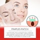 thumbnail image 5 of Limited time discount!Acne Patch For Skin Cleaning, Acne Warts, Skin Labels, Wart Cleaning, Closing Mouth, Gentle Fading, Acne Balance, Skin Acne Patches, 5 of 8