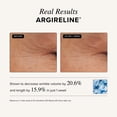 thumbnail image 4 of ASTERWOOD S&eacute;rum Facial con Matrixyl 3000 y Argireline - Con &aacute;cido hialur&oacute;nico - 29 ml, 4 of 7