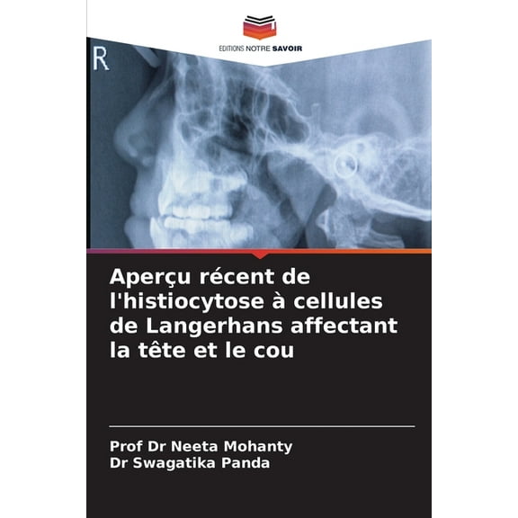 AperÃ§u rÃ©cent de l'histiocytose Ã  cellules de Langerhans affectant la tÃªte et le cou, (Paperback)