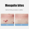 Bug Bite Itch Relief Tool USB Rechargeable Mosquito Bite Sucker