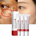thumbnail image 2 of Crema facial para manchas oscuras, hidratante, antienvejecimiento, 20 g, 2 of 9