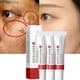 thumbnail image 2 of Crema facial para manchas oscuras, hidratante, antienvejecimiento, 20 g, 2 of 9