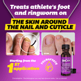 thumbnail image 5 of SILKA - Ultimate Kit: Cream, Nail Liquid, Powder and Spray Multi (1 Pack), 5 of 11