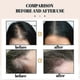 thumbnail image 4 of Rice Water Shampoo Bar Hair Growth Shampoo Soap Bar Hair Regrowth -, 4 of 5