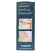 ScarSof Scar Treatment Cream with Vitamins A & E, Organic Aloe Vera, Cocoa Butter, and Emu Oil
