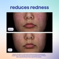 thumbnail image 4 of Bruma Facial de Ácido Hipocloroso Skin Spritz Method 250 ml, 4 of 9