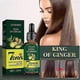 thumbnail image 2 of piezas de 30 ml de aceite esencial de jengibre para el cuidado del cabello, 7 días de duración, mejora el entorno del cuero cabelludo, tratamiento contra la caída del cabello, aceite esencial para e, 2 of 5