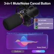 Socodox XLR/USB Dynamic Microphone Kit, PC Mic for Streaming,Podcasting,Gaming,RGB,Mute and Noise Cancelling Function,Volume Control,Headphone Jack