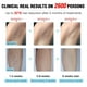thumbnail image 5 of Depiladora Permanente IMENE Azul con Tecnología IPL Efectiva para Mujer y Hombre, 5 of 6
