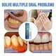 thumbnail image 4 of Gum Shield Gel, Gum Treatment Gel, Gum Disease Treatment Teeth Whitening Essence for Gum Repair, 4 of 4