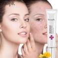 thumbnail image 2 of Extracto De Acné Eliminación De Marcas De Acné Facial(Compre 2 y ahorre 10%), 2 of 6