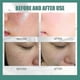 thumbnail image 4 of 3pcs Goat Milk Silk Soap Acne Removing And Skin Cleansing Soap Bar Silk Protein Skin Repair Moisturizings Mite Removal, 4 of 4