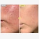 thumbnail image 2 of Crema facial hidratante TOSOWOONG Black Snail Mucin 92% 100 ml, 2 of 6