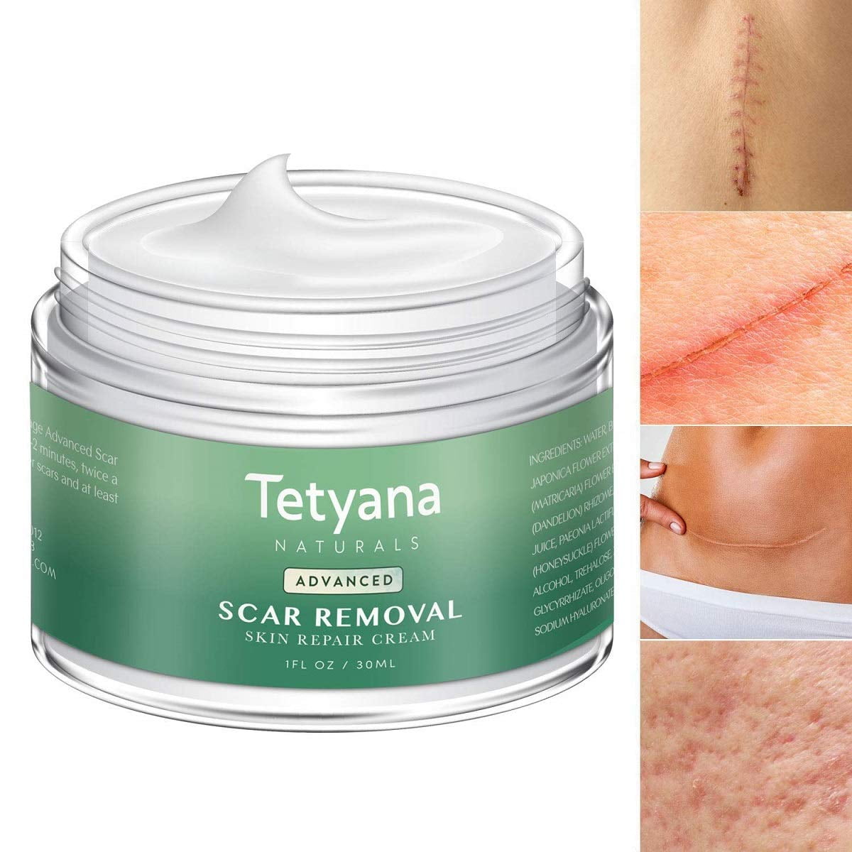 best lotion for removing scars