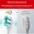 thumbnail image 2 of Colgate Total Adult Sonic Battery Powered Electric Toothbrush, Soft, 2 of 7
