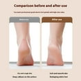 thumbnail image 4 of Electric Foot Callus Remover, Professional Adjustable Speed Electric Foot File Pedicure Tool for Dead Dry Crack Calluses, 4 of 5