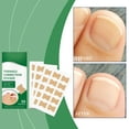 thumbnail image 4 of Parches correctores de uñas que corrigen y alivian suavemente las molestias de las uñas encarnadas y realzan la belleza. Parches para el cuidado de las uñas. Corrección de uñas., 4 of 9