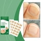 thumbnail image 4 of Parches Correctores para Uñas Encarnadas | Material Suave y Transpirable | Paquete de 50 Unidades, 4 of 7