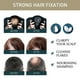 thumbnail image 3 of Champú para el crecimiento del cabello Champú para mujeres Hombres Anti-caída del cabello Cuidado del cabello Ndcxsfigh  Cuidado Belleza, 3 of 5