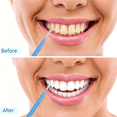 thumbnail image 7 of ACDANC 100 Pieces Braces Dental Brush for Cleaner Interdental Toothpick Dental Tooth Flossing Head Oral Hygiene Flosser Toothpick Cleaners Tooth Tool, 7 of 7