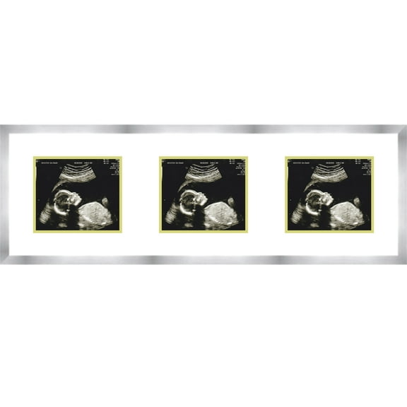 16x5 Silver Sonogram Frame with White on Green Mats with 3 Openings to Display 3 4x3 Sonograms -