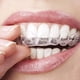 thumbnail image 2 of 4 bandejas bucales para blanqueamiento dental/gel blanqueador, protector bucal termoformado, 2 of 5