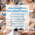 thumbnail image 6 of Glycolic Acid Exfoliating Body Stick with 10% Shea Butter, Dual Action Exfoliating & Moisturizing Care, 75g(2Pack), 6 of 9