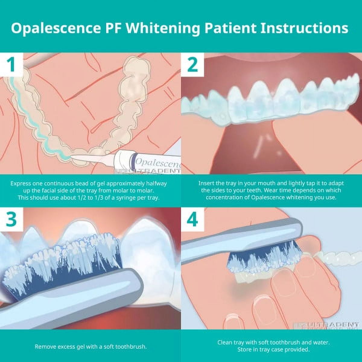Opalescence Teeth Whitening Gel Syringes 10% Mint - Teeth Whitening, Oral Health - 4 Syringes