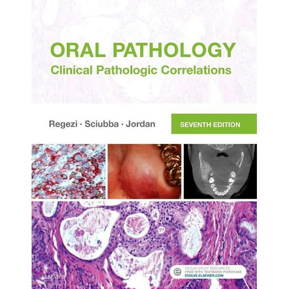 Oral Pathology: Clinical Pathologic Correlations, (Hardcover)
