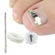 thumbnail image 1 of Herramienta de corrección de uñas encarnadas Macarena tratamiento de uñas acero inoxidable, 1 of 8