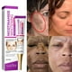 thumbnail image 2 of Crema iluminadora de melasma niacinamida, Reduce la melanina, piel oscura, cloasma, suero para aclarar, desvanece las líneas finas, productos de cuidado coreanos para la cara, 2 of 5