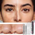 thumbnail image 5 of Blackhead Remover Blackhead Tweezers Facial Blackhead Remover Tweezers Professionals Facial Blackhead Remover Tweezers Set, 5 of 6