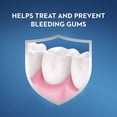thumbnail image 2 of Crest Pro-Health Multi-Protección CPC Antigingivitis/Antiplaca Enjuague Bucal Menta Limpia 8.4Oz, 2 of 9