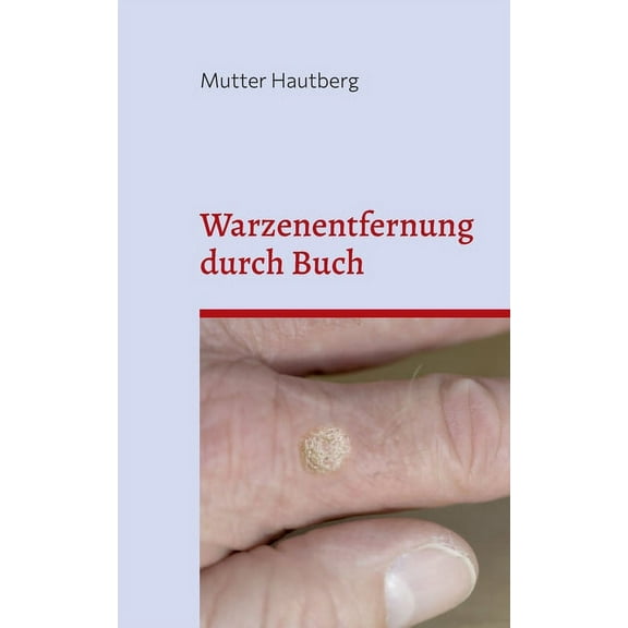 Warzenentfernung durch Buch: Heilung durch gespeicherte uralte BesprechEnergie, (Paperback)