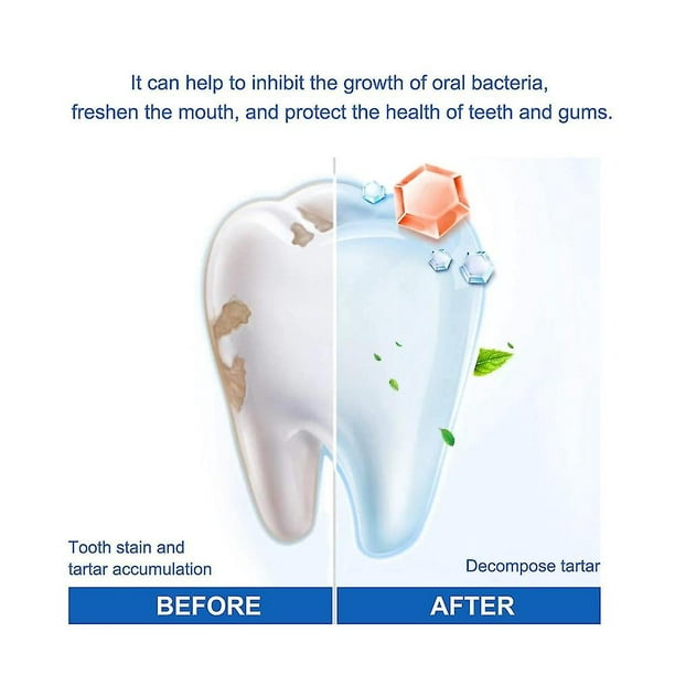 5ml 35% Peroxyde d'hydrogène Double baril Blanchiment dentaire Soins bucco- dentaires Gel blanchissant des dents