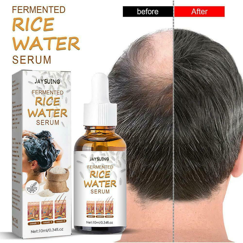Hair Growth Products Rice Water Hair Growing Essential Oil Serum Hair Care  Prevent Hair Loss Scalp 30ml| AliExpress | Hair Growth Products Rice Water Hair  Growing Essential Oil Serum Hair Care Prevent