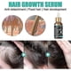 thumbnail image 3 of Jaysuing Dense Hair Essence Repair And Moisturize Dry Hair To Prevent Dense Hair, 3 of 5