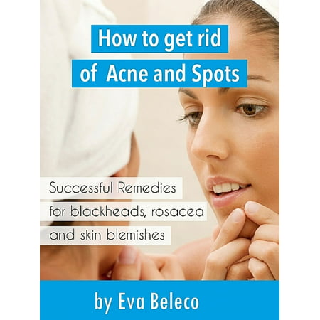 How to Get Rid of Acne and Spots - eBook (Best Products To Get Rid Of Spots)