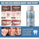 thumbnail image 2 of Durable Dental Cement for Secure Tooth Repair, 2 of 5