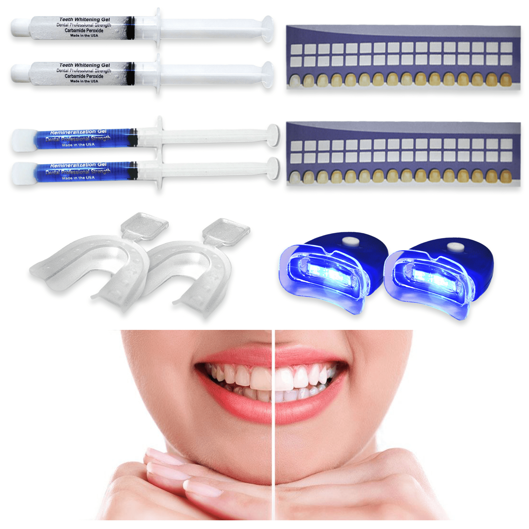 Always White Premium Teeth Whitening Kit for Two - 35% Whitening Gel Syringes - Made in USA