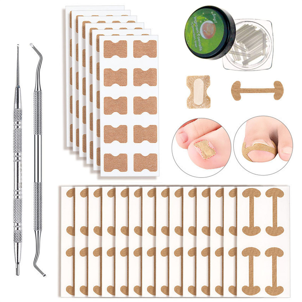 Ingrown Toenail Corrector Strips 152 Pieces Ingrown Toenail Tool Set