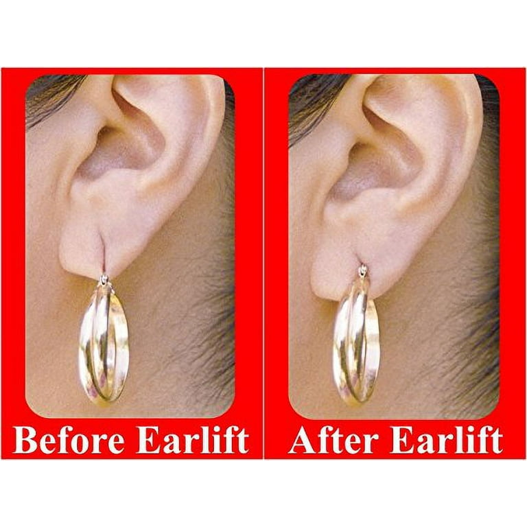  Earlift Invisible Ear Lobe Support Solution Support Peel &  Press for Pierced Ears As Seen On Tv- 180 Count : Health & Household