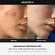 thumbnail image 4 of Dispositivo de tratamiento facial Medicube Age-R Booster-H, 4 of 7