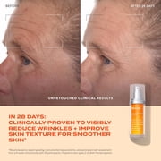Murad Rapid Dark Spot Correcting Serum, Even Skin Tone, 1 fl oz