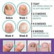 thumbnail image 5 of 100ML Medinail Fungus Repair Spray For Foot,Nail, Soft Nail, Yellow Hair Care, 5 of 5
