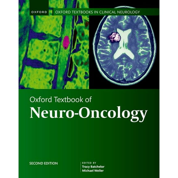 Oxford Textbooks in Clinical Neurology Oxford Textbook of Neuro-Oncology, (Hardcover)
