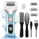 thumbnail image 1 of Removedor eléctrico de callos de pies, recargable, portátil, electrónico, kit de pedicura, resistente al agua, lima de fregado de pies, herramientas profesionales de pedicura, cuidado de pies para pie, 1 of 5